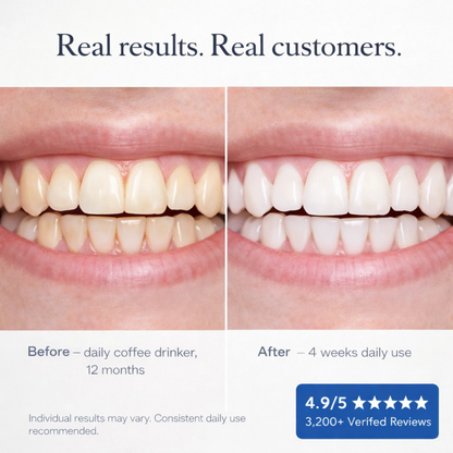 RinseReset Premium Whitening Mouthwash